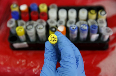 Meningoencefalitis, la nueva amenaza del zika 2 1903 AGREGADO%202